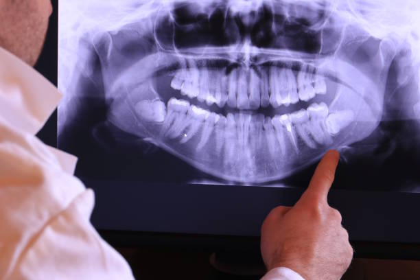 Best Dental Abscess Treatment in Milroy, PA