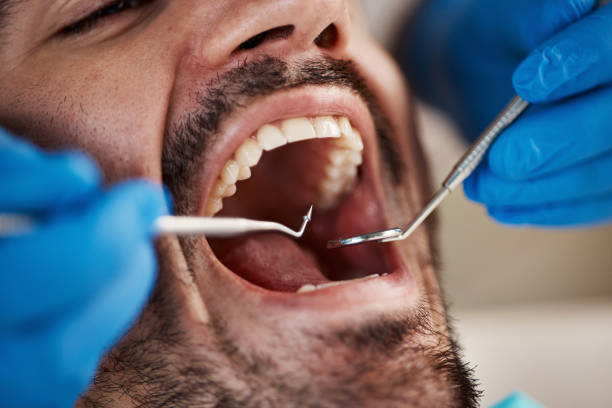 Best Walk-In Emergency Dental Services in Milroy, PA