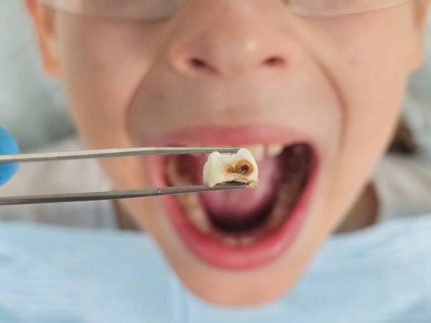 Best Emergency Pediatric Dental Care in Milroy, PA