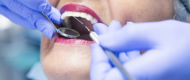 Best Dental Abscess Treatment in Milroy, PA